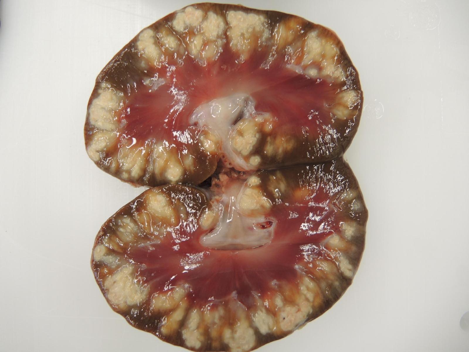 Pseudotuberkolose